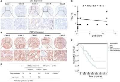 p53 Affects PGC1α Stability Through AKT/GSK-3β to Enhance Cisplatin Sensitivity in Non-Small Cell Lung Cancer